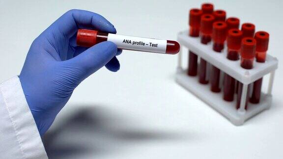 抗核抗体档案医生在试管中展示血液样本实验室研究健康检查