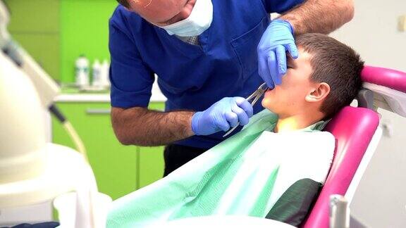 牙医用特制的钳子给男孩拔牙