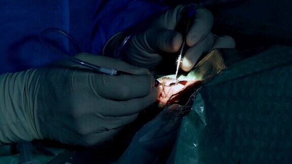 眼科显微手术手术
