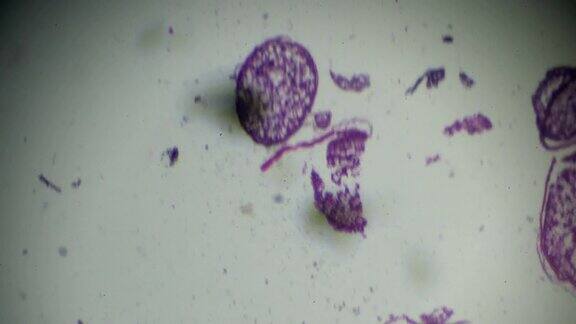 显微镜下鱼卵巢横切面