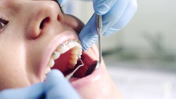 牙科诊所里戴着牙套的年轻女子