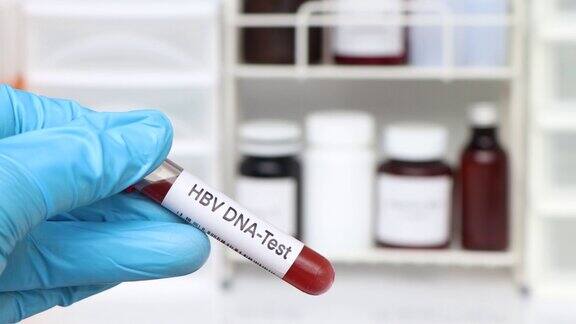 HBVDNA测试从血液中寻找异常
