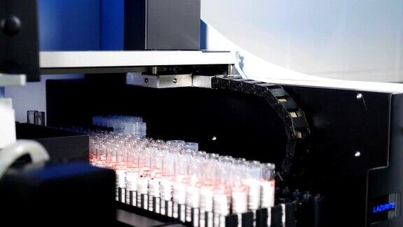 健康用于人体血液分析的专业医疗设备用于将样本和血管装入医学实验室的自动分析仪的支架4k的视频