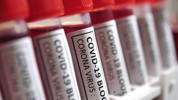 COVID-19血液试管