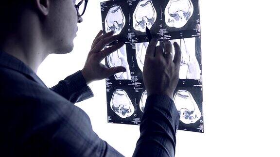 医生通过关节的x光片检查关节的MRI快照