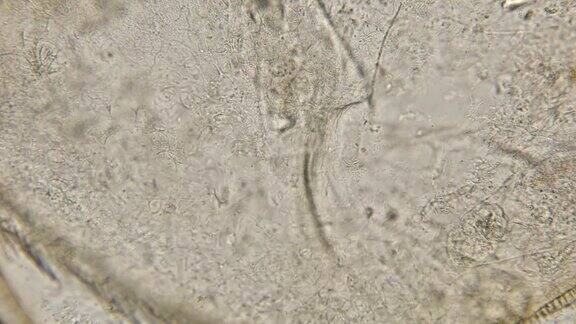 显微镜下的细菌螺旋体菌落