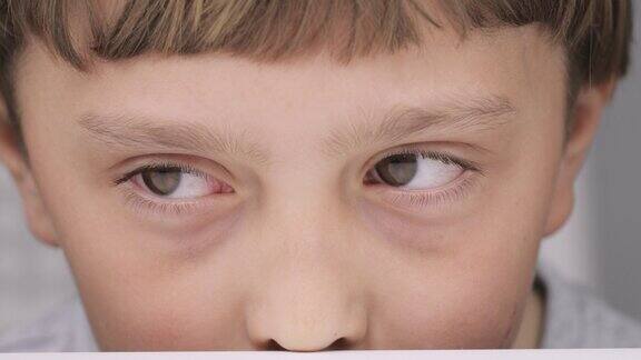 一个9岁白人男孩的眼睛特写