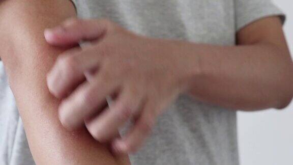 年轻的亚洲男子瘙痒和抓挠手臂上的瘙痒干燥的皮肤湿疹皮炎