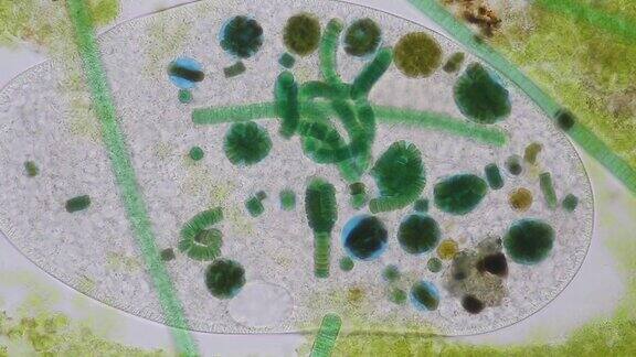 在显微镜下Frontoniasp.是一种自由生活的单细胞纤毛虫原生生物