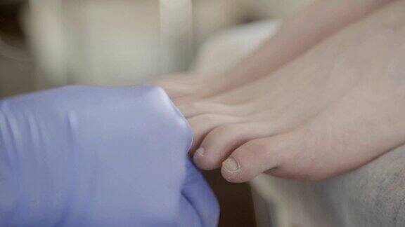 手戴手套的特写切割病人脚指甲的角质层