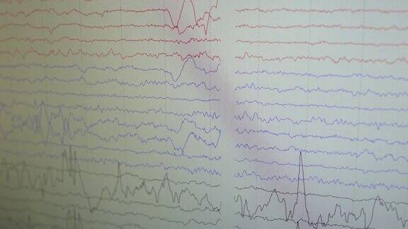电脑显示器显示脑电波