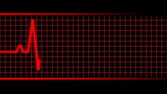 红色心电图机无缝循环HD1080i