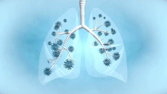 肺大流行疾病-4K分辨率