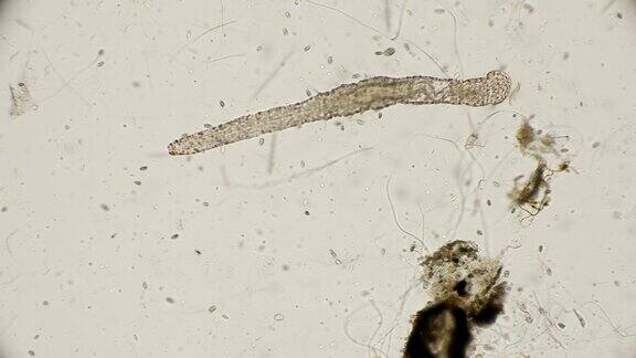 在显微镜下观察到的一种线虫