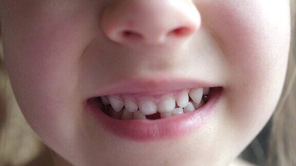 小女孩有了第一颗乳牙
