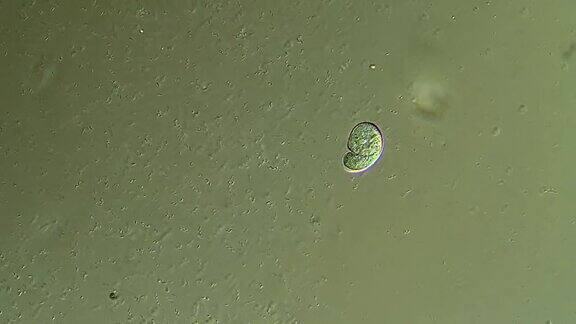 纤毛虫微生物显微镜观察