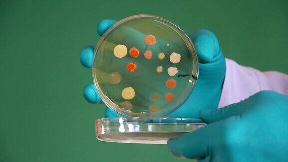 实验室助理开培养皿细菌琼脂