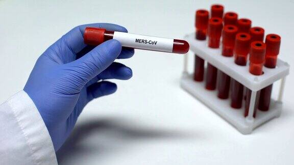 mers冠状病毒医生在试管中展示血液样本实验室研究健康检查
