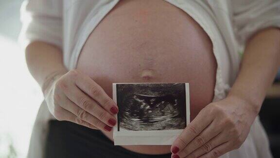 一名无法辨认的怀孕晚期妇女展示了她未出生婴儿的超声波扫描