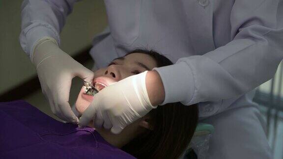 牙医检查病人牙齿保持美丽的笑容