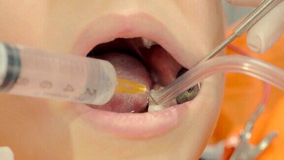 牙医用注射器在一个小孩的牙齿上注射
