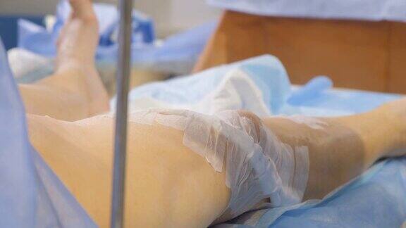 外科医生在手术后检查病人腿部静脉的特写静脉曲张