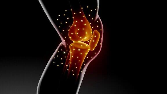 膝关节疼痛有治疗作用