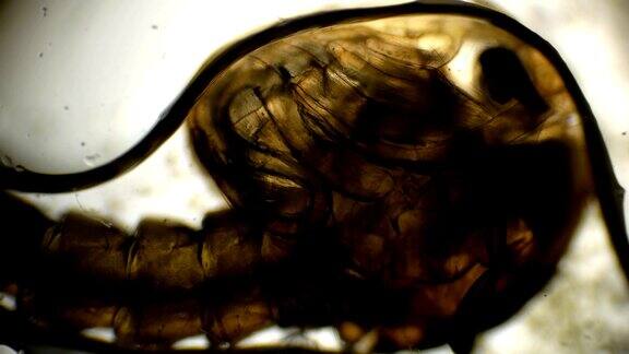 maculipennis按蚊幼虫的显微镜观察