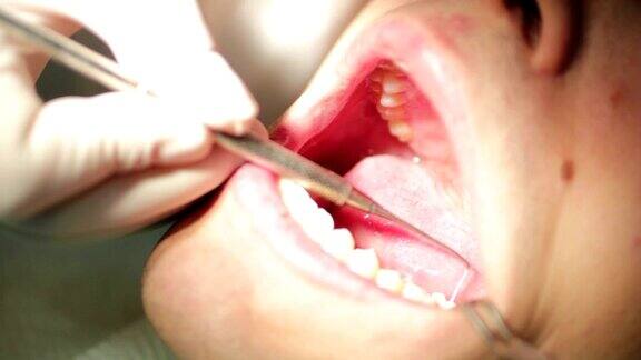 牙科医生-在口腔检查时把病人张开的嘴闭合