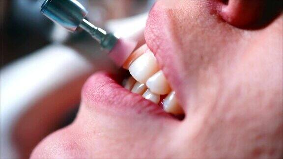 近距离观察牙齿清洁在牙科柜中女性的牙齿