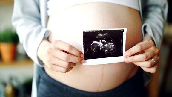 近距离拍摄孕妇的肚子和女性的手握超声波图像的健康未出生的孩子怀孕、医疗和幸福家庭理念