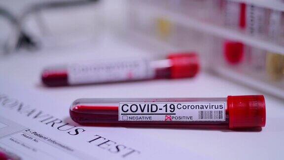 冠状病毒COVID-19检测新型冠状病毒