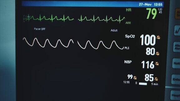 黑屏上有两条波浪线监测手术病人的生命体征关闭了