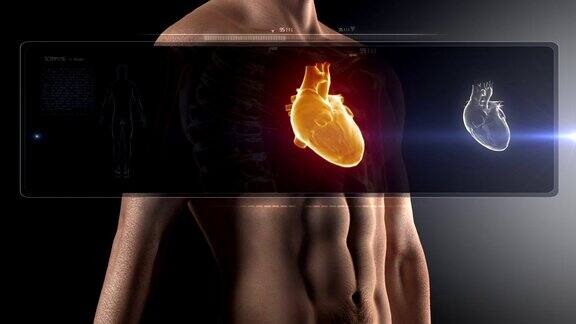 人体心脏扫描