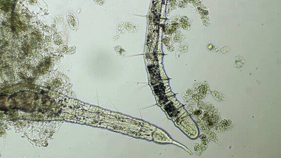 显微镜下的蠕虫-少毛纲Naididae