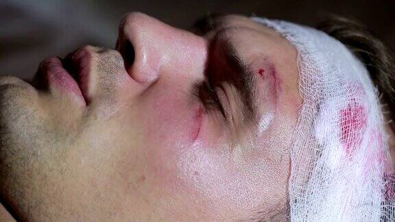 一个头部受伤的人躺在床上缠着绷带脸上有淤青