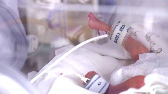 产科中心重症新生儿孵化器医院强化治疗:CCUICUITU那个小婴儿使劲地动着他的手指、脚和腿关闭了