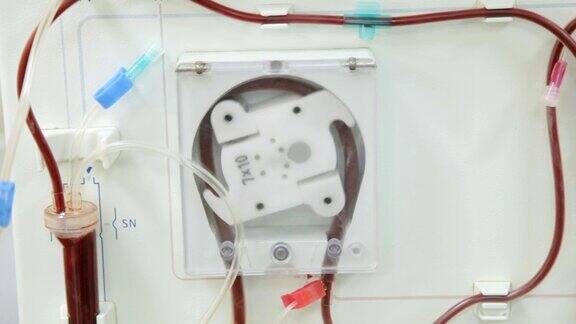 现代透析机在透析科进行血液净化