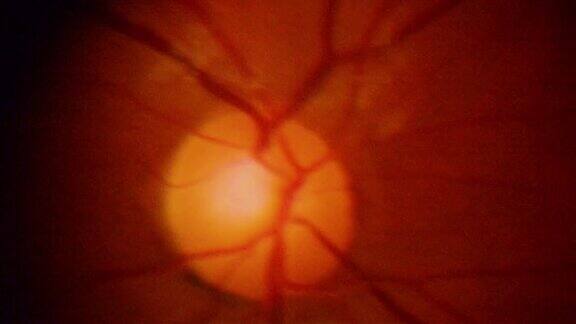 眼睛的视网膜特写