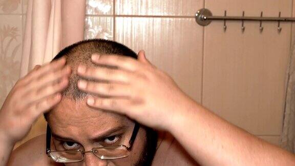 年轻的秃顶男人戴着眼镜在浴室里检查他的头和秃顶感到很沮丧脱发问题