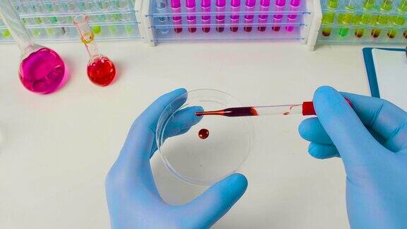 视频FullHD特写-医生滴入受感染的血液样本到皮氏培养皿中进行研究