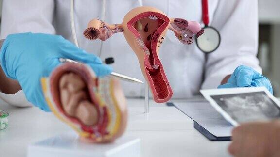 妇科医生在诊所向妇女展示子宫和胎儿的模型