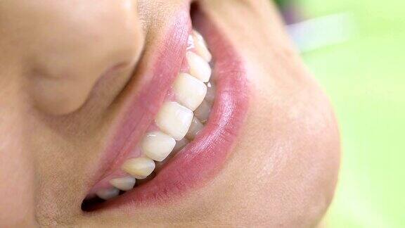 妇女健康微笑近距离例行牙科保健检查就医