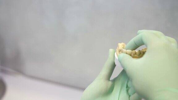 牙科医生检查牙齿贴面的质量和颜色