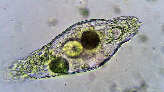 在死轮虫体内漂浮的微生物纤毛虫