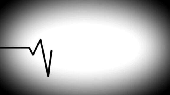 心电图(EKG或ECG)环路黑白相间