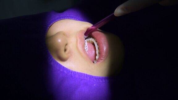 牙科医生正在给病人的牙齿动手术