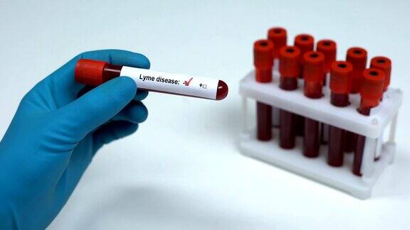 莱姆病检测阴性医生提供血样实验室研究保健