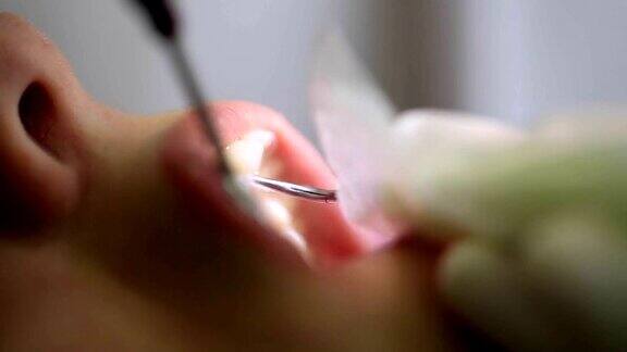 牙医在牙科医生处作口腔检查时应将病人张开的嘴巴封闭