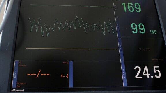 心电图的显示病人心跳和血压的电活动图心电图或心电图屏幕上的图表婴儿heartbeat.4k4k的视频